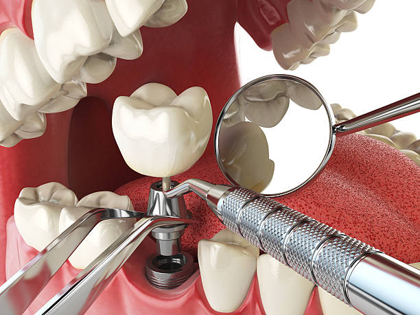 Best Emergency Denture Repair in Franklin, WI